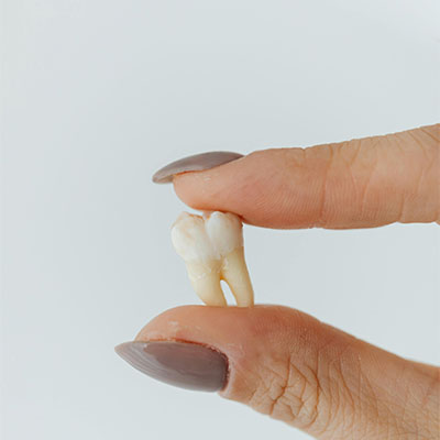 Wisdom Tooth Inflammation: Causes, Symptoms, And Treatment